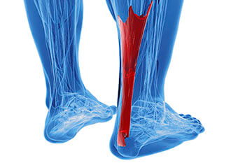 achilles tendon treatment in the West Hollywood, CA 90048 area