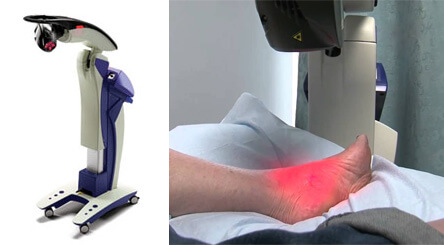 mls laser therapy in the West Hollywood, CA 90048